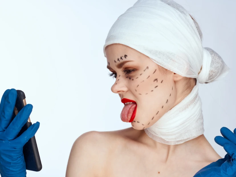 3 tendencias de medicina estética peligrosas en redes sociales por qué son un NO rotundo