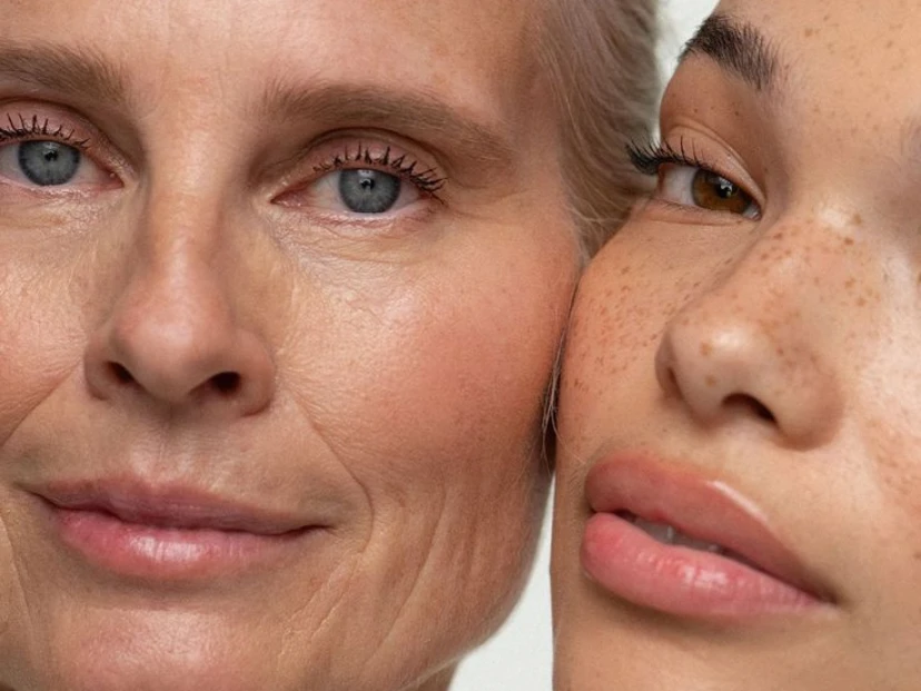 Cómo evitar las manchas en la piel: la clave está en usar protector solar incluso en invierno