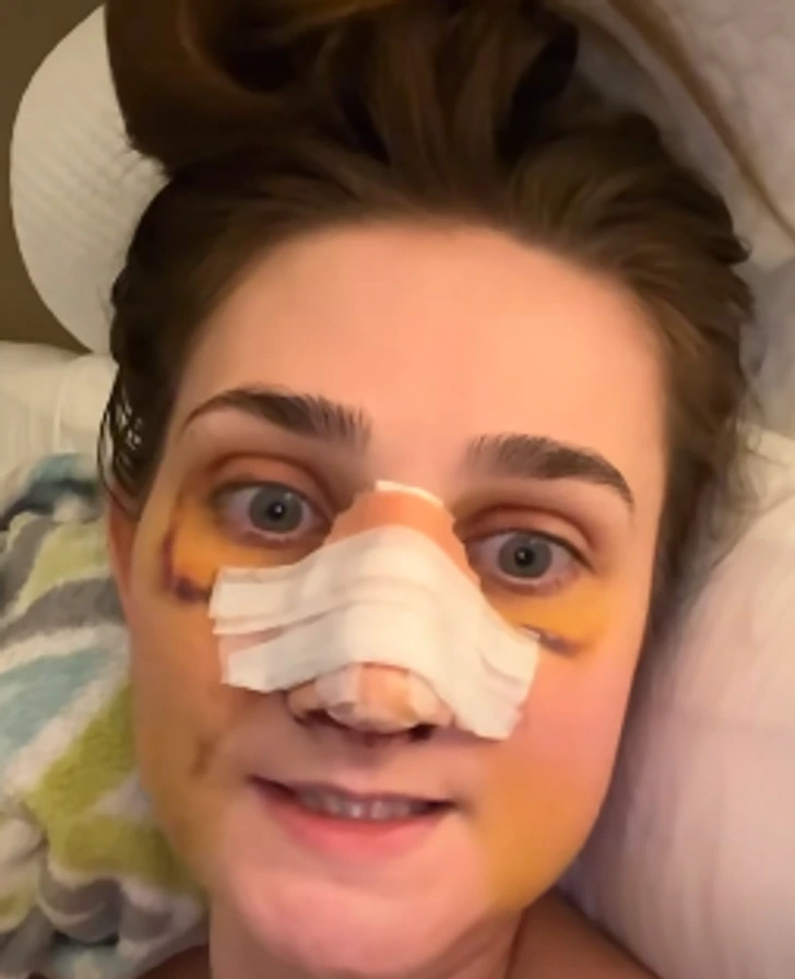 Una cirugía de nariz le cambió la vida 