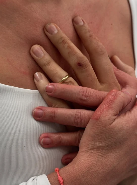 La foto que compartió María Claudia Tarazona el día del ataque