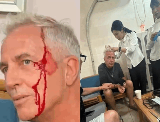 Marley se accidentó en Tailandia donde está grabando "Por el mundo": qué le pasó