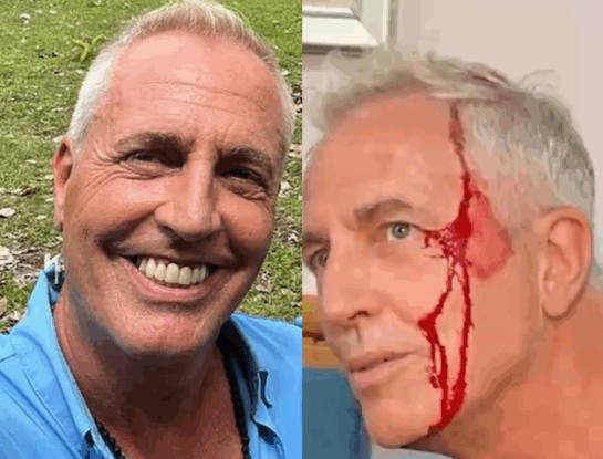 Así fue el dramático golpe que sufrió Marley mientras grababa “Por el Mundo” en Tailandia