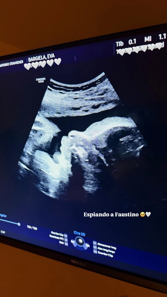 Eva Bargiela mostró una ecografía de su hijo en camino. Foto: IG