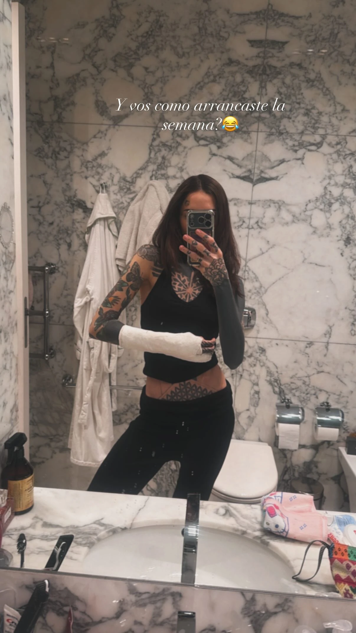 Cande Tinelli mostró cómo le quedó la mano tras la caída. Fotos: IG.