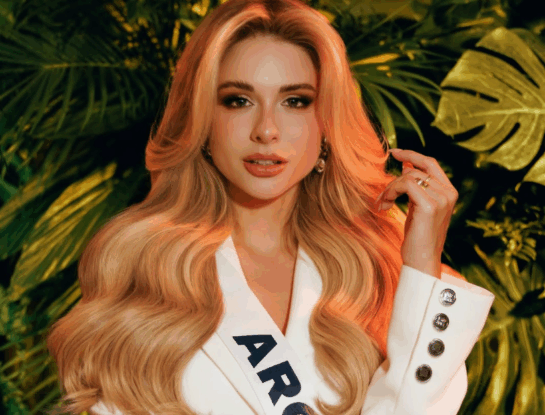 Quién es Aldana Masset, la modelo argentina que reveló tener alopecia y representará al país en Miss Universo 2025