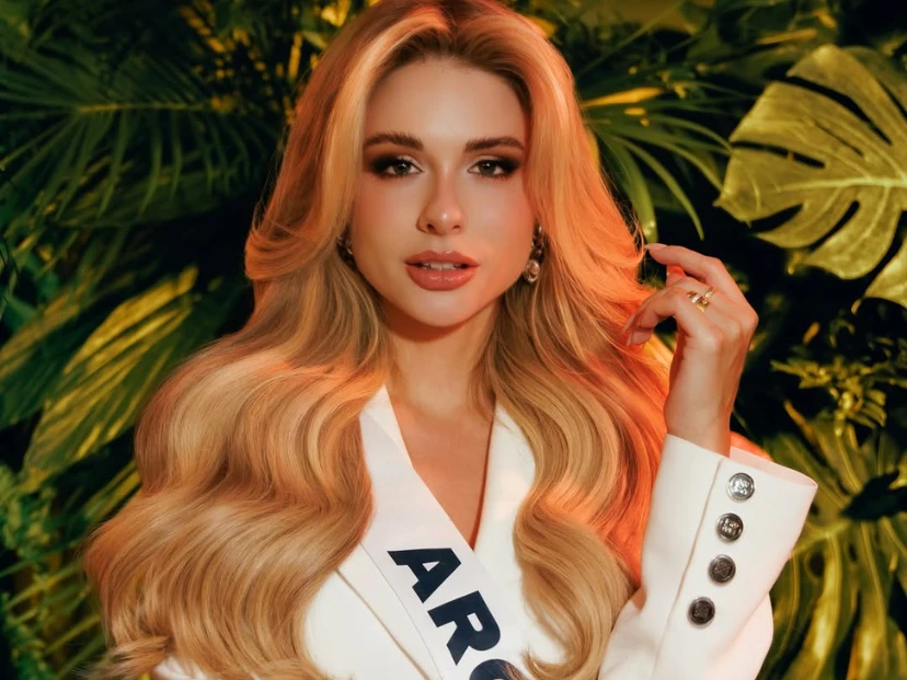 Quién es Aldana Masset, la modelo argentina que reveló tener alopecia y representará al país en Miss Universo 2025