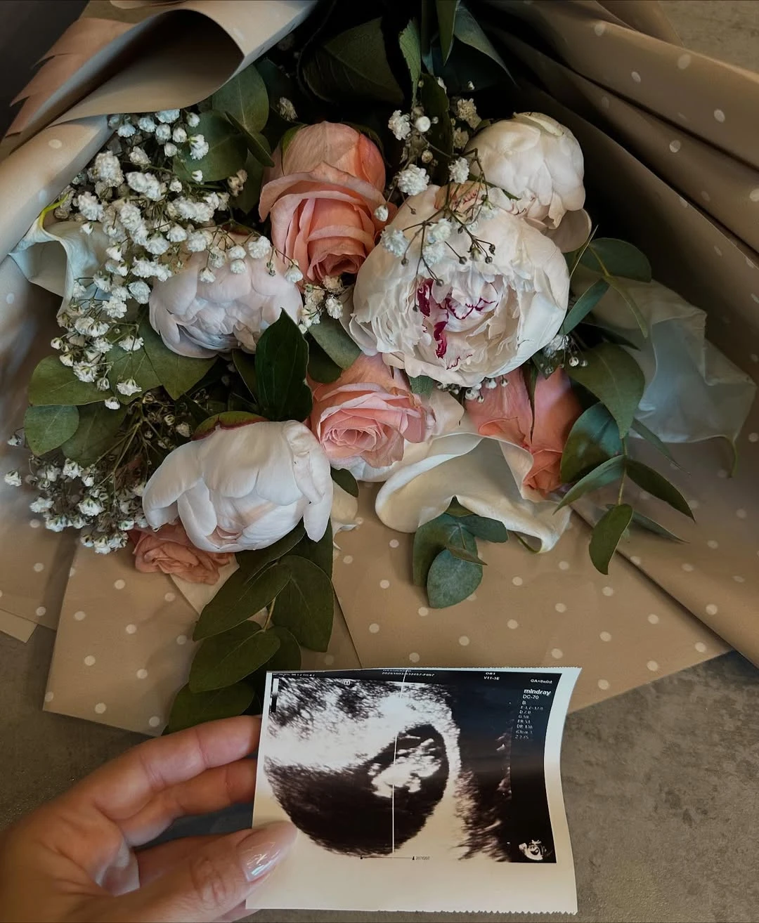 La pareja presentó la primer ecografía en sus redes. Fotos: IG.