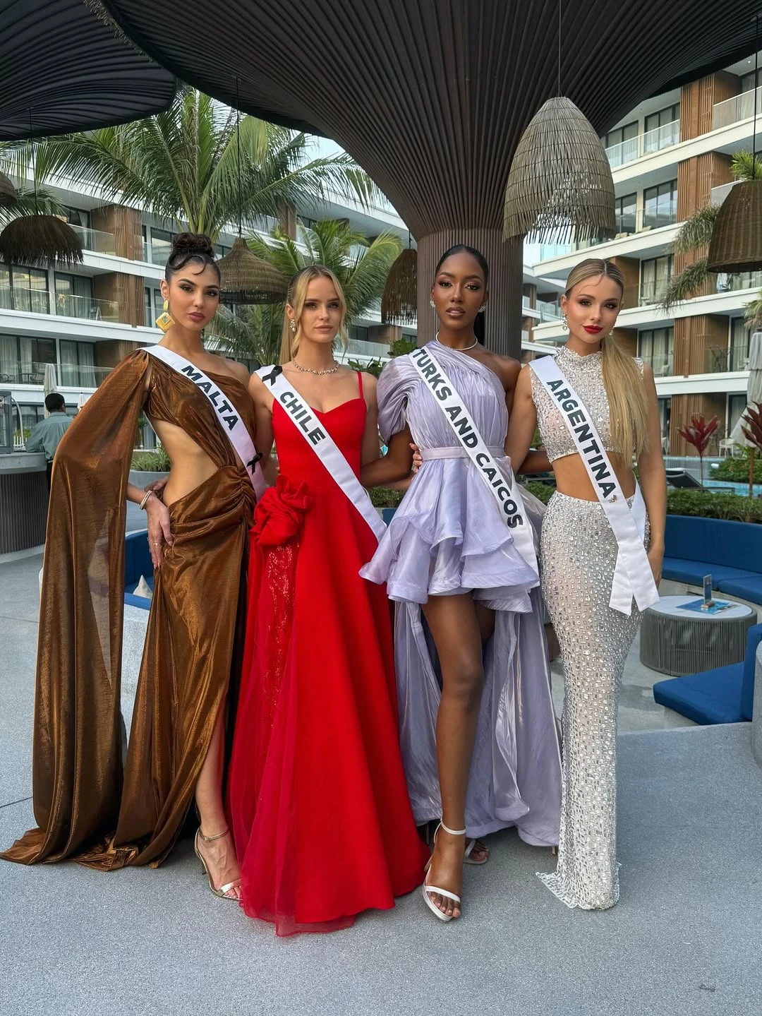 Quién es Aldana Masset, la modelo argentina que reveló tener alopecia y representará al país en Miss Universo 2025