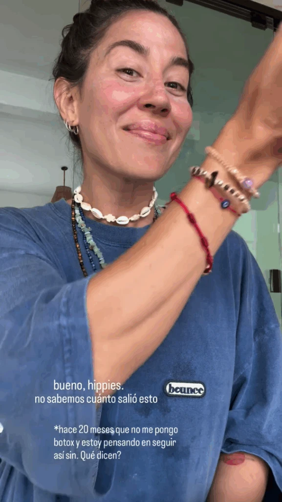 Jimena Barón explicó por qué dejó de aplicarse bótox y pidió la opinión de sus seguidoras