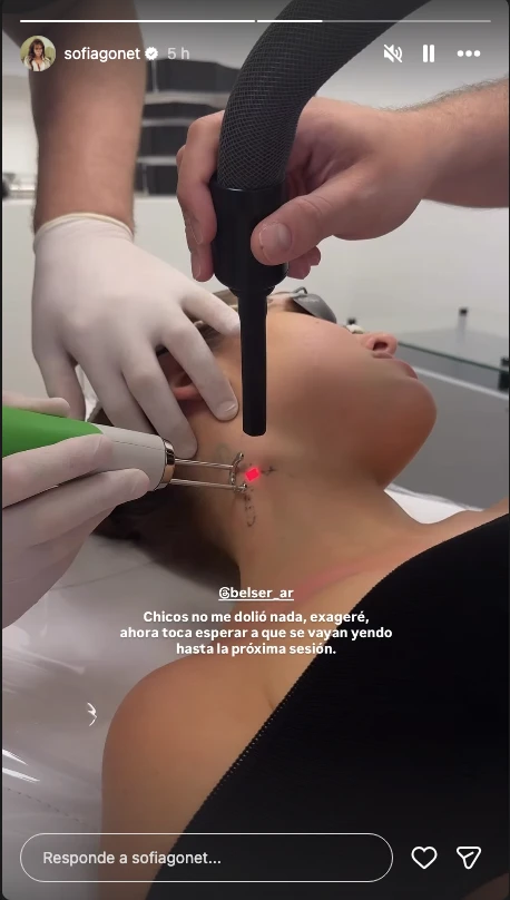 El cambio radical de Sofía “la Reini” Gonet: por qué decidió borrarse tatuajes