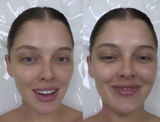 El nuevo "retoque" estético de Sofía Gonet, la Reini: qué se hizo y por qué