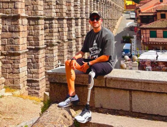 Nacho Heinze, un año después de perder una pierna: su historia de resiliencia