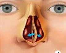 tabique nasal