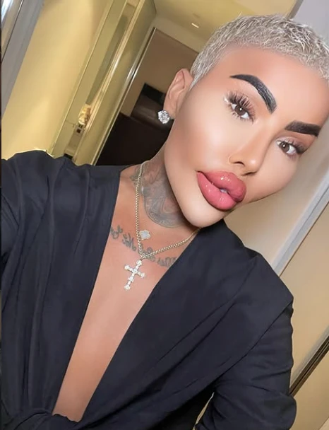 El último retoque de Jordan James Parke: la trama detrás de la muerte del influencer británico