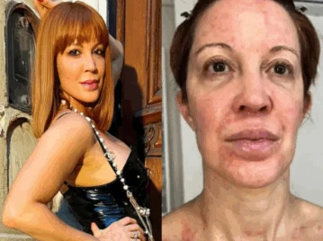 Miriam Lanzoni destacada