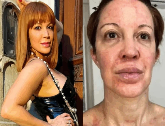 Miriam Lanzoni destacada