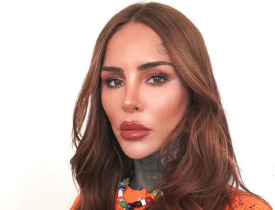 La revelación de Cande Tinelli: "Tengo fobia social"