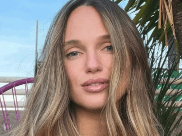 "Sobrevivir no fue casualidad": la historia de Katya Komleva, la influencer que transformó sus quemaduras en un mensaje de amor propio