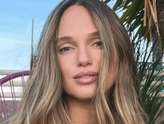 "Sobrevivir no fue casualidad": la historia de Katya Komleva, la influencer que transformó sus quemaduras en un mensaje de amor propio