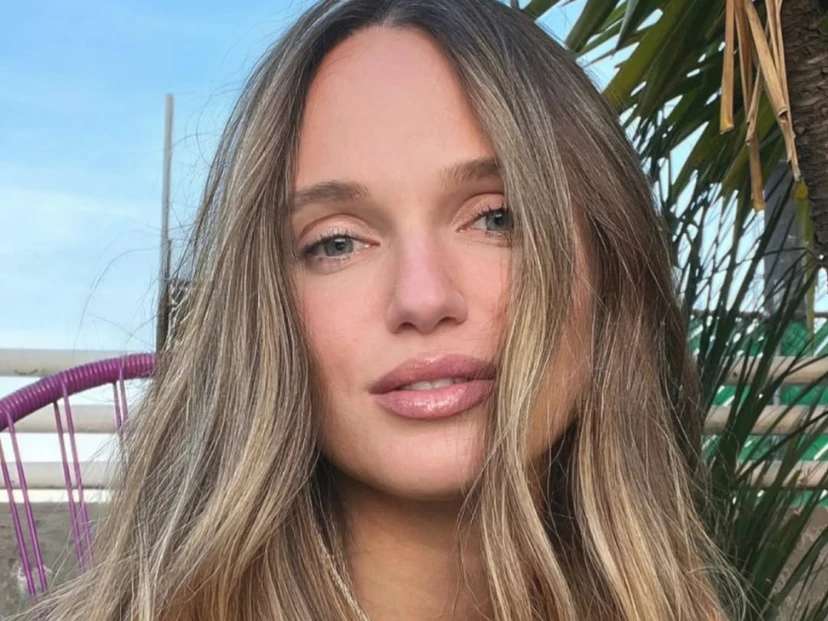 "Sobrevivir no fue casualidad": la historia de Katya Komleva, la influencer que transformó sus quemaduras en un mensaje de amor propio