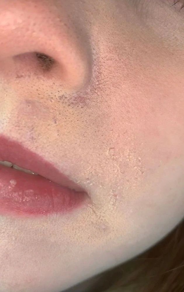 Uno de los errores más frecuentes es no hidratar la piel antes de maquillarte. Este paso es clave para lograr un acabado parejo.