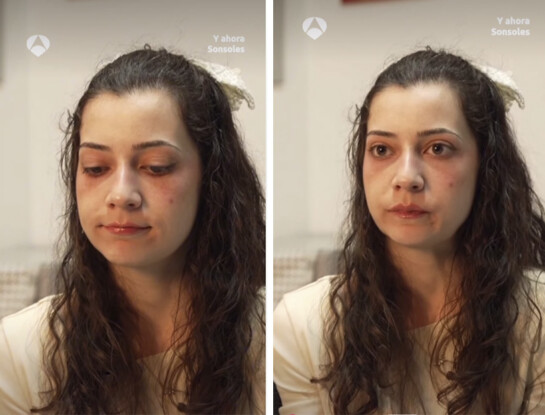 El crudo testimonio de Noelia, la joven española que recibirá la eutanasia a pesar de la negativa de su padre: "Me la hacen el 26"