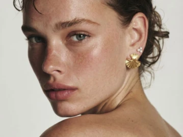 ¿Te quedaron manchas después del sol? Podría ser melasma (y no lo que pensabas)