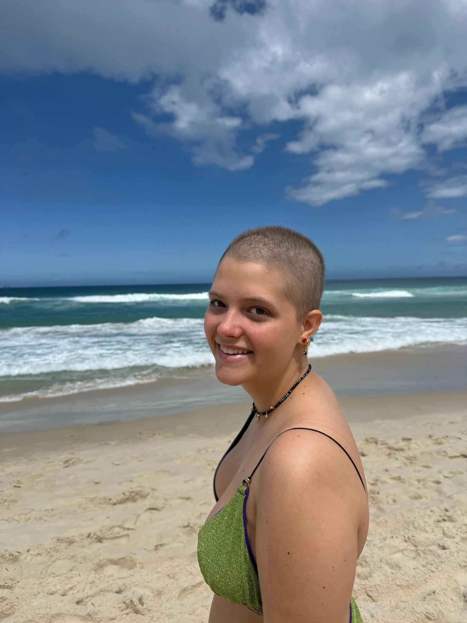 Fátima tuvo a los 19 años un cáncer de pulmón muy poco frecuente. 