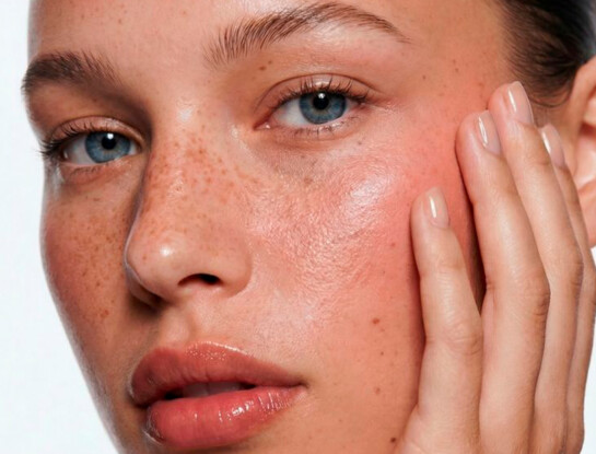 Rosácea: por qué no es solo un problema de la piel (y el error que todos cometen al tratarla)