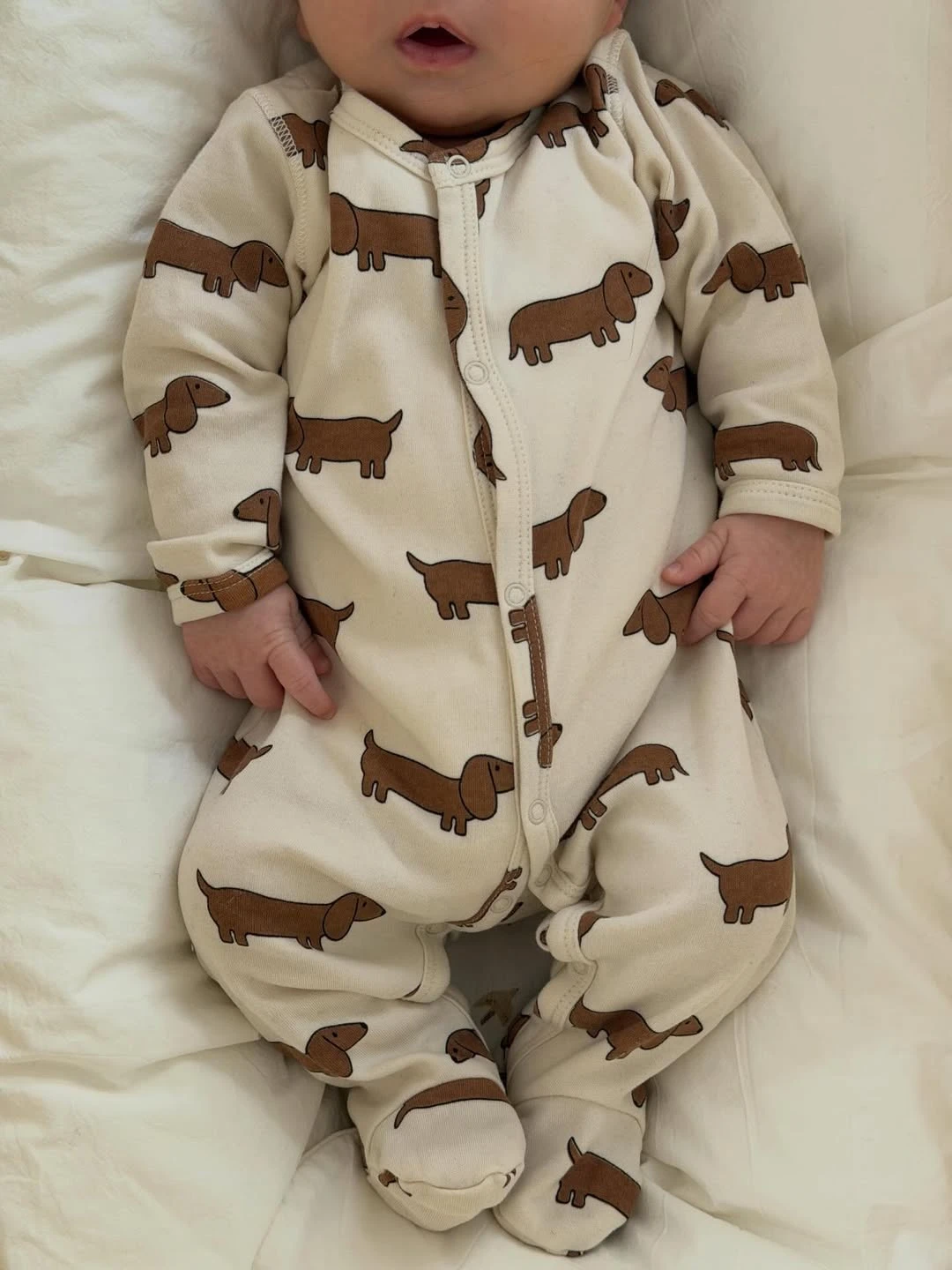 Dante con un enterito estampado. Fotos: IG. 