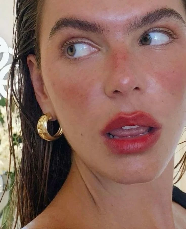El sunburn blush hace referencia a las quemaduras por el sol.