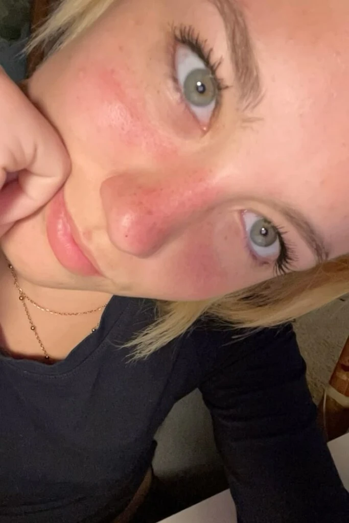 El sunburn blush se viralizó en las redes sociales.