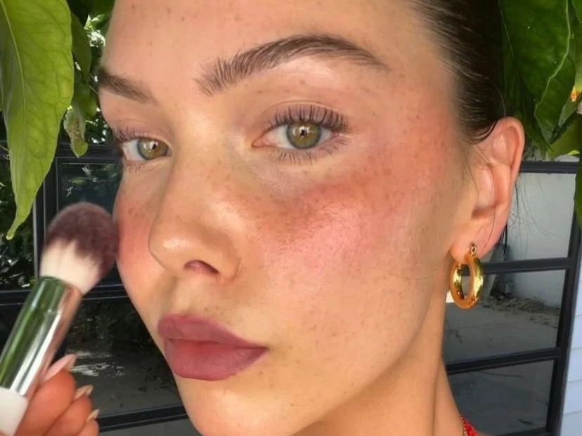 Sunburn blush: la tendencia beauty que genera debate en redes porque está inspirado en las quemaduras de sol