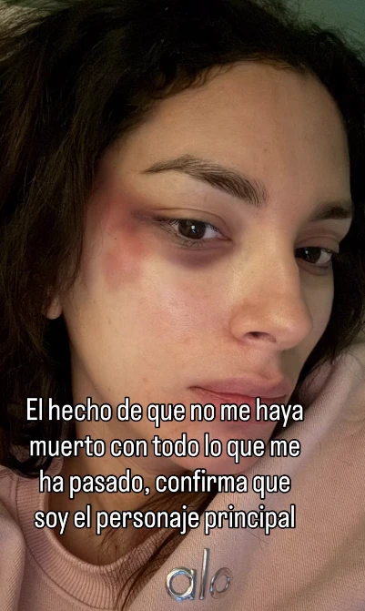 Golpes en el rostro, la foto que subió en uno de sus últimos posteos