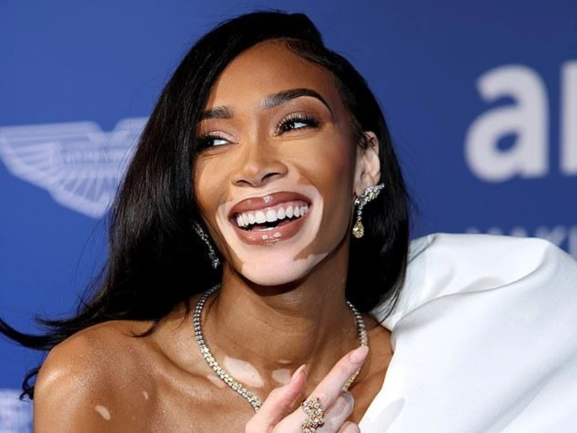 El vitiligo: por qué es una enfermedad y no una cuestión estética