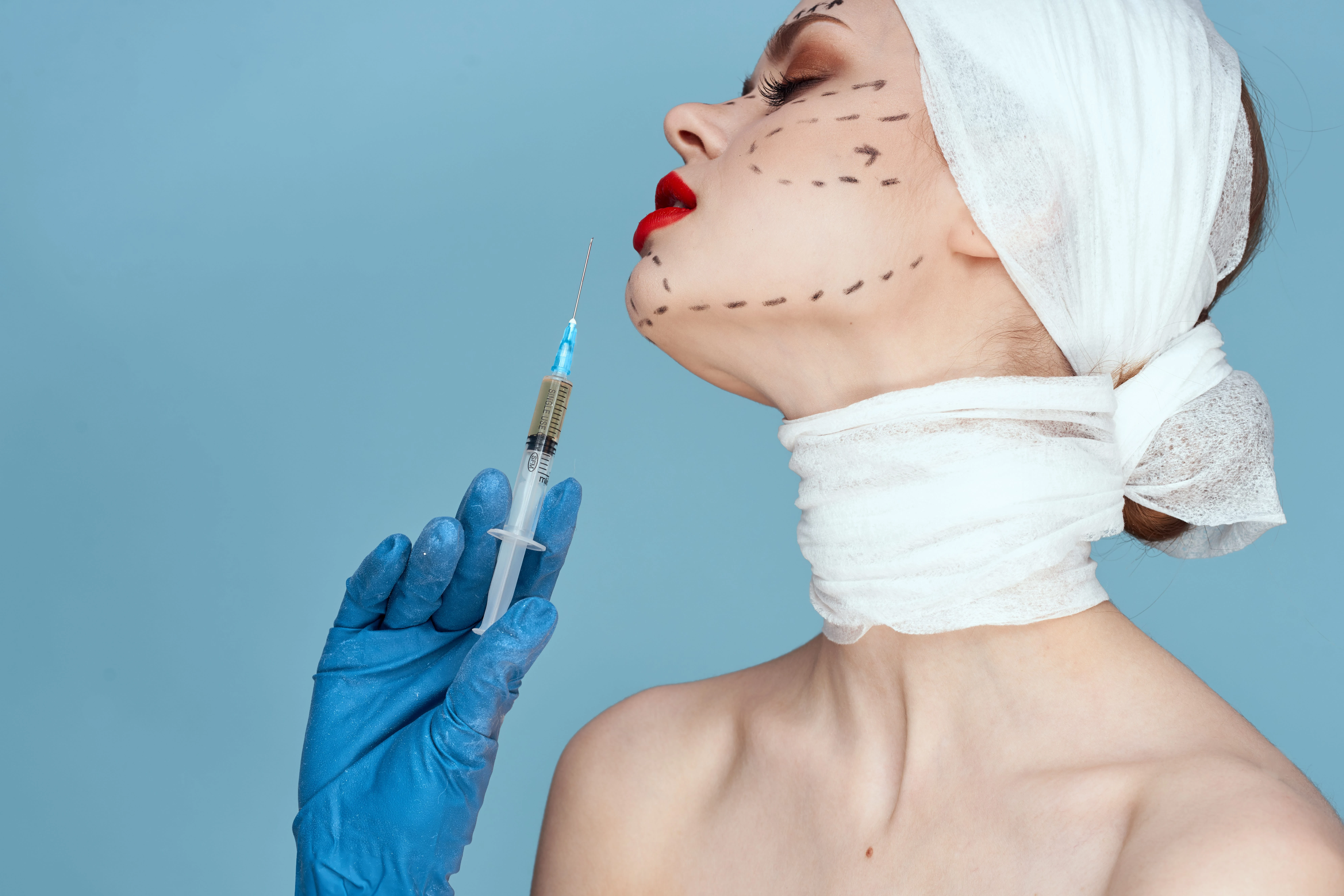 Zombie fillers: el polémico relleno con tejido de donantes que nació tras el boom del Ozempic