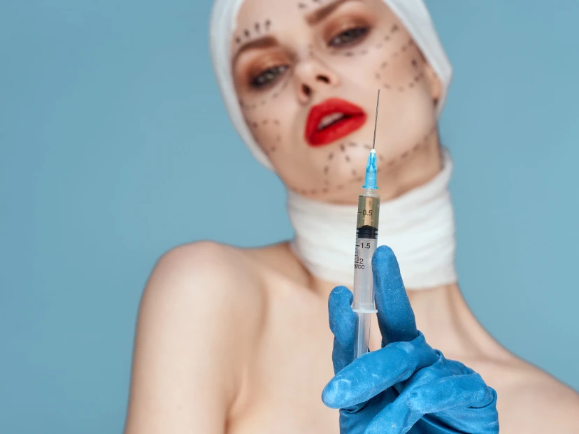 Zombie fillers: el polémico relleno con tejido de donantes que nació tras el boom del Ozempic