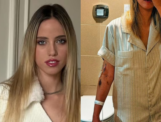 Denisse González mostró los impactantes síntomas físicos que enfrenta durante su tratamiento