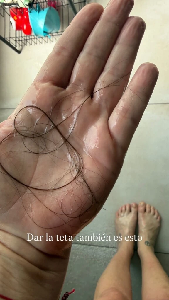 La fotografía fue tomada mientras se duchaba y se lavaba el cabello. Al pasar la mano por su pelo, Juana se encontró con una importante cantidad de cabello desprendido y decidió compartir la situación con sus seguidoras.