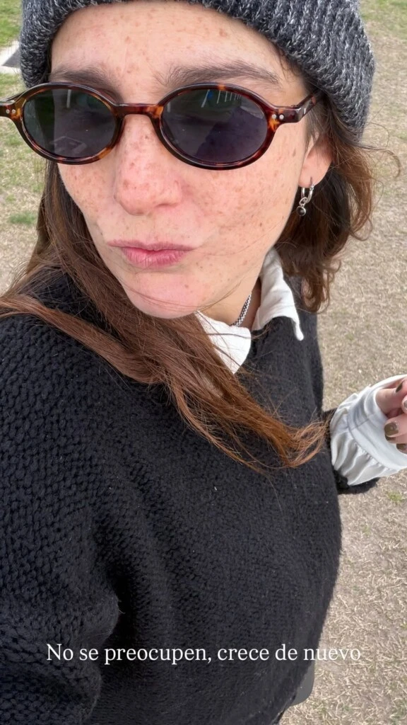 Juana, lejos de alarmarse, eligió tomárselo con humor y llevar tranquilidad. En una segunda publicación, escribió: “No se preocupen, crece de nuevo”.